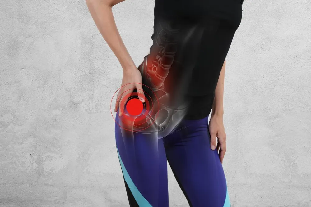 hip bursitis runner